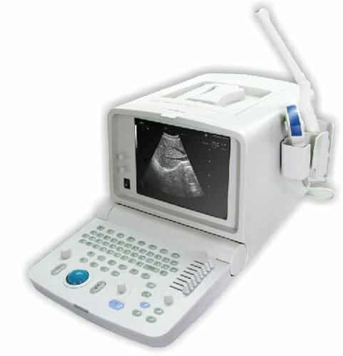 US 100 ULTRASOUND MACHINE