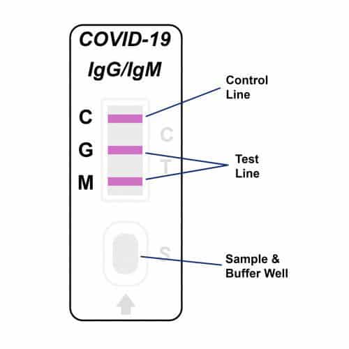 Covid19 Test Kit IgG IgM
